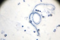 【動画】男性の陰嚢でダンスする寄生虫