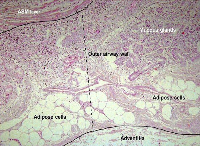 fatty-tissue-2.jpg