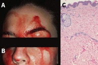 血が噴き出る「最も奇妙な症例」の女性、診断は血汗症