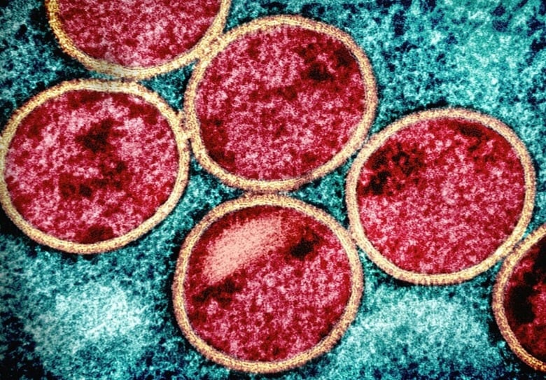 National Institute of Allergy and Infectious Diseases-Unsplash