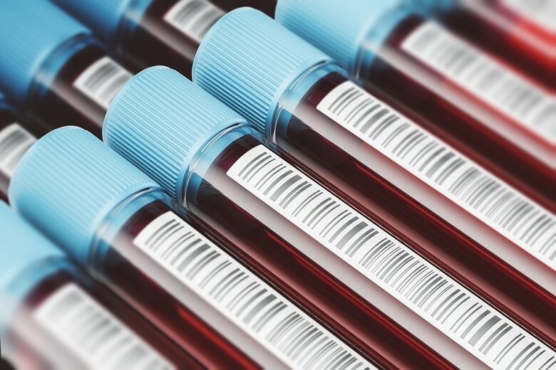 採取された血液サンプル（写真はイメージ）　ImageFlow-shutterstock