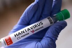 ハンタウイルス、米国民へのリスク「低い」とＣＤＣ説明