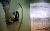 中国の公立病院で患者5人がHIV感染、医療器具の使い回しで