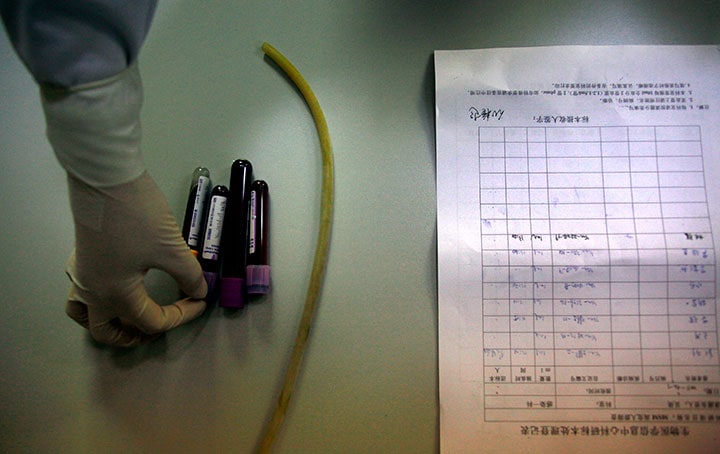 中国の病院の杜撰な実態が明らかに（写真はイメージで記事の内容とは関係ありません）　David Gray-REUTERS