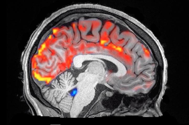 脳脊髄液の波が老廃物を洗い流す......   Laura Lewis