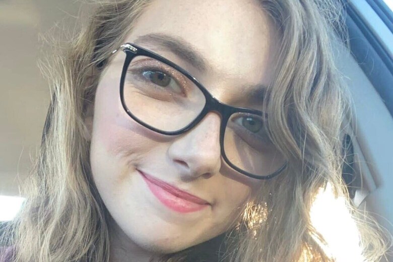 4度の蘇生から4年...犬に襲われた女性、奇跡の生還と再生の記録　jacqueline_claire99-Instagram