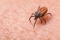 【画像】「写真を見て血の気が引いた...」下半身に約40匹のマダニが付着...男を襲った悲劇