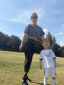 義足をつけたジョディ・ヒギンスさん　jodie_heart_transplant_journey
