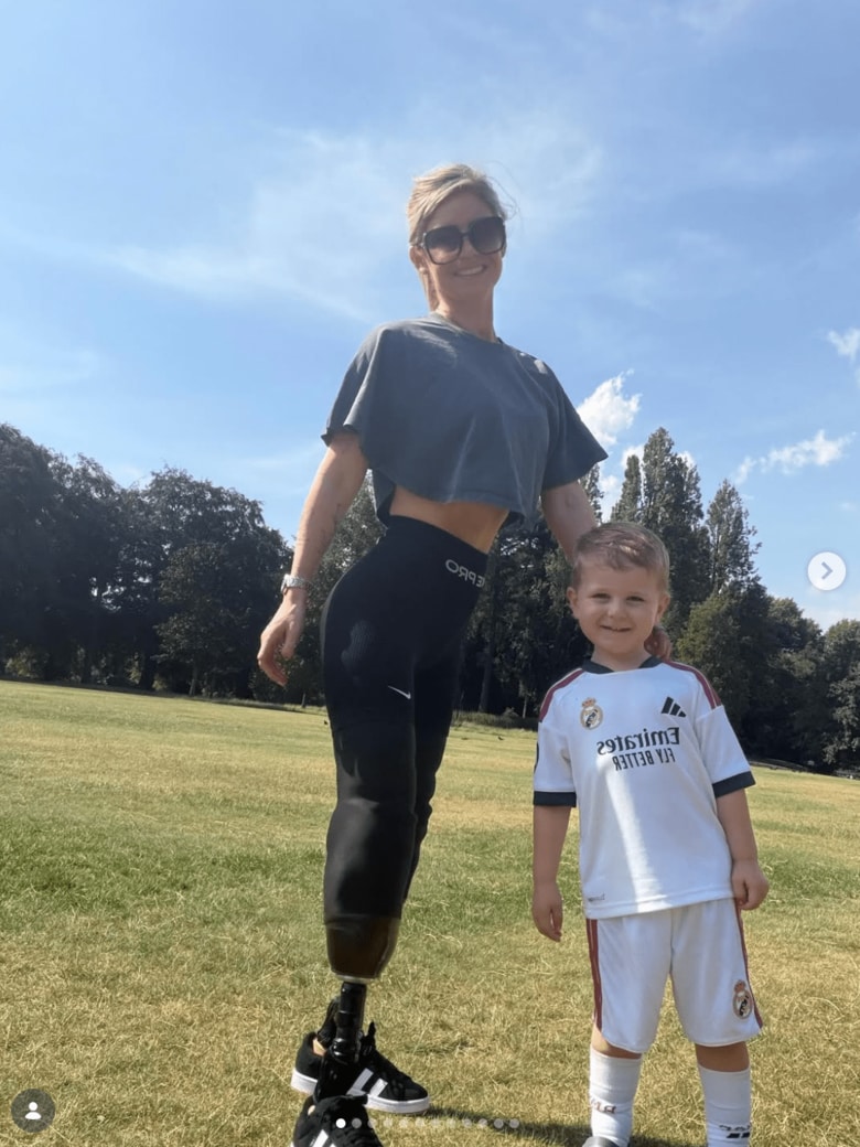 義足をつけたジョディ・ヒギンスさん　jodie_heart_transplant_journey