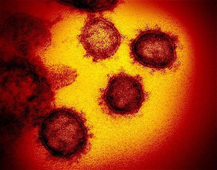 塩野義製薬は27日、新型コロナウイルス感染症に対する予防ワクチンの開発を正式に決定したと発表した。NIAID-RML/Handout via REUTERS.