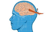 ADHDに「倫理に反する。費用もかかる」救世主が現れた？