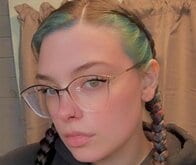 ピットブルに「顔の半分」を嚙みちぎられた女性…耳、鼻、唇、頬を失った姿を公開し、支援を募る