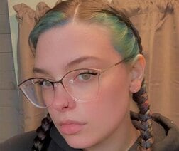 ピットブルに「顔の半分」を嚙みちぎられた女性…耳、鼻、唇、頬を失った姿を公開し、支援を募る