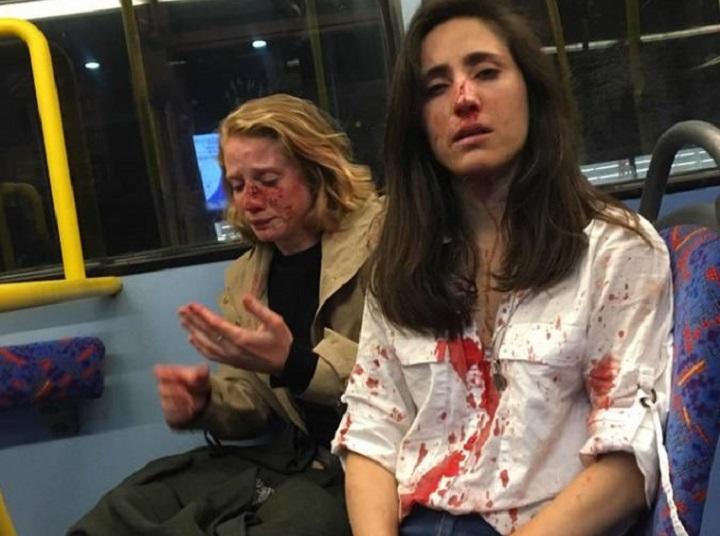 襲われた直後のヘイナモト（右）とガールフレンドのクリス　FACEBOOK/MELANIA GEYMONAT