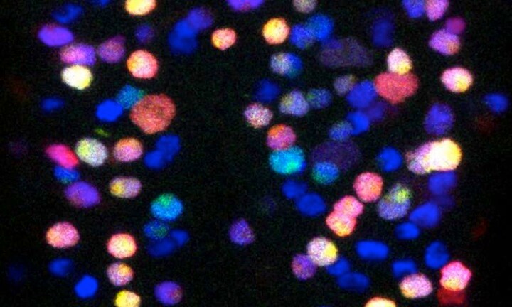 ショウジョウバエの脳の幹細胞。緑色/赤色/黄色が新しいニューロンを生成している　Credit: Andrea Brand/Leo Otsuki