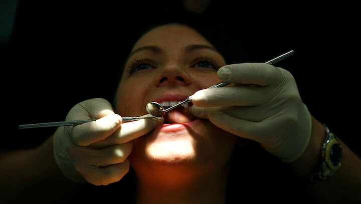 イギリスでは虫歯の治療に12ヶ月待ちを記録する異常事態となっている...... REUTERS/Phil Noble (BRITAIN)