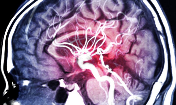 脳へ刺激を与えると同時にデータ収集もでき、理想的な研究プラットフォームになり得る？　mr.suphachai praserdumrongchai-iStock