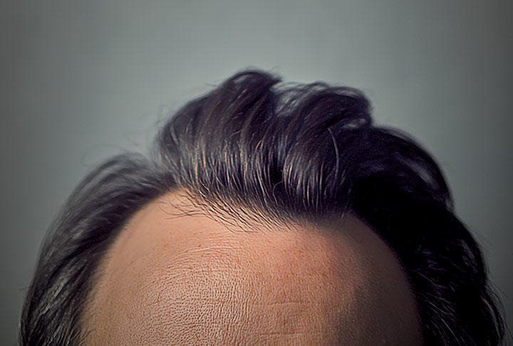 なぜ体には毛がフサフサのところとツルツルのところがあるのか　Jonathon Rusnak-Eyeem/GETTY IMAGES