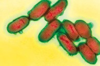 かつて大流行したペストが、ヒトの遺伝子を強化したという研究結果──新型コロナウイルスは？