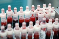 「回復した人の3割が十分な抗体を持たず」と中国の研究結果：新型コロナウイルス