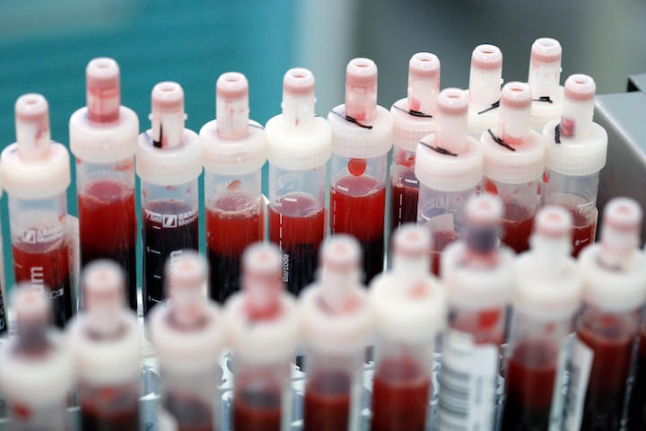 今後、さらに解明していく必要があるが...... REUTERS/Axel Schmidt