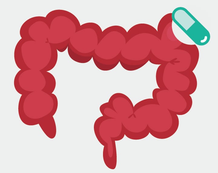 恐い感染症を「便カプセル」で手軽に治療　Baluchis/iStock.