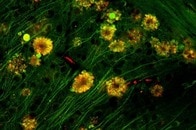 「神経細胞に出現する『毒の花』がアルツハイマー病に関与している」との研究結果