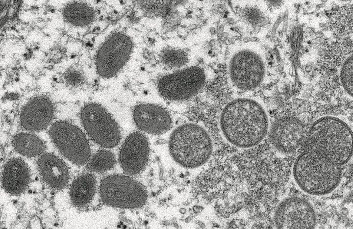 サル痘感染で世界に懸念が広がるが　CYNTHIA S. GOLDSMITH, RUSSELL REGNERYｰCDCｰHANDOUTｰREUTERS