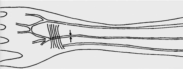 Human-Forearm.jpg