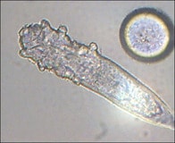 ヒトの顔の皮膚に寄生するニキビダニは寄生生物から共生生物に変化しつつあった