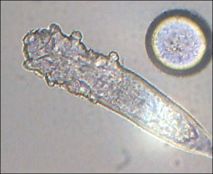 ヒトの顔の皮膚に寄生するニキビダニ　wikimedia
