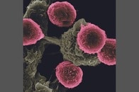 「健康な細胞は傷つけない」──副作用を「マスク」で防ぐ、がん治療薬の可能性・最新研究