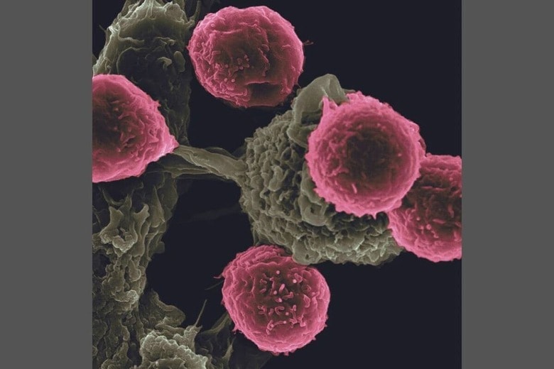 IL-12のような樹状細胞（緑）が免疫細胞（赤）に「攻撃」指示を出す VICTOR SEGURA IBARRA AND RITA SERDA, PH.D., NATIONAL CANCER INSTITUTE, NATIONAL INSTITUTES OF HEALTH