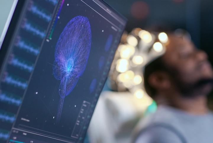 脳の信号を理解可能な音声に直接変換するシステムが開発された（写真はイメージ）gorodenkoff -iStock