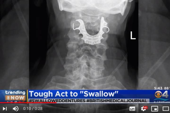 CBS Miami-YouTubeより