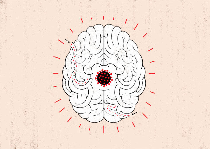 ILLUSTRATION BY ALEX FINE