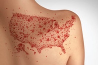 アメリカの「ワクチン接種率」はなぜ下がったのか？...予測モデルが示す「20年後のシナリオ」