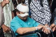 捜査官に硫酸かけた犯人を捜せ　インドネシア大統領､関与が疑われる警察に再捜査指示