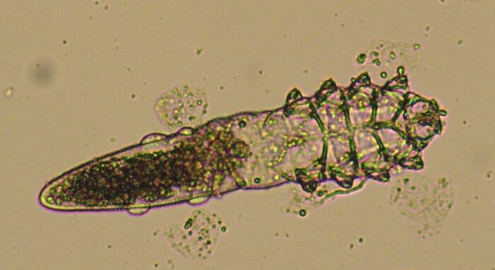 demodex-underside.jpg