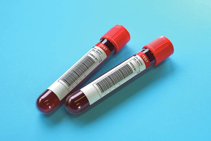 血液検査による抗ミュラー管ホルモンの値に注目 ANDY/ISTOCKPHOTO