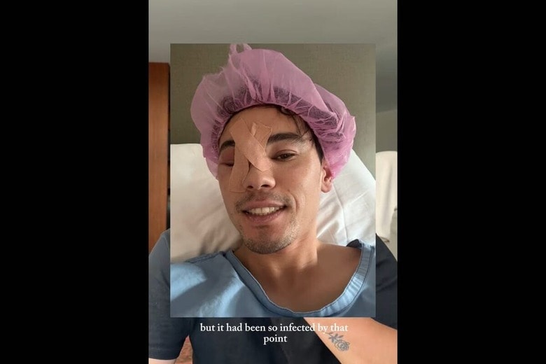 顔のできもので手術を受けたカイ・デービッドソン　@_lifeofkaiiii_ / TikTok