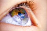 「レーベル先天黒内障」とは何か？...画期的な「遺伝子治療薬」で視力改善へ【最新研究】