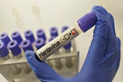 【クイズ】世界が恐れるハンタウイルスを世界で初めて分離した国は？