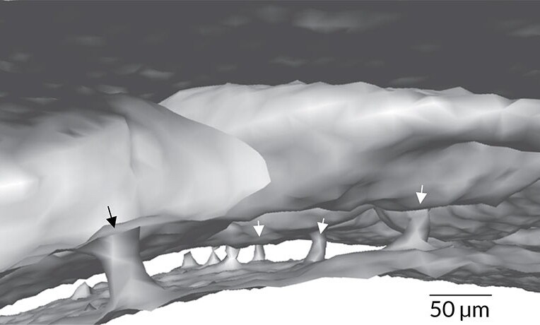 頭骨と脳を直接結ぶトンネルが発見された Credit: Gregory Wojtkiewicz, Center for Systems Biology, Massachusetts General Hospital