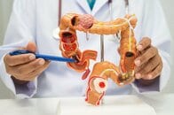 肉の食べすぎでは説明できない…日本人の大腸がんが世界トップクラスに増えた本当の理由