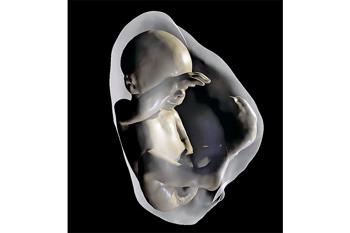 Radiological Society of North America