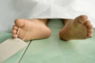 男性は女性の3倍近く“突然死”する――法医学者が6000体の解剖から見た「死に方と生き方」の深い関係
