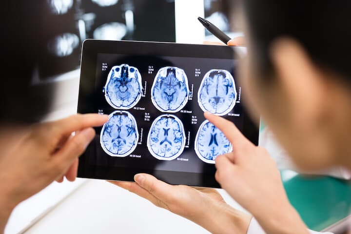 減少の原因はまだ明らかになっていないが......  （写真はイメージ）Nikada-iStock