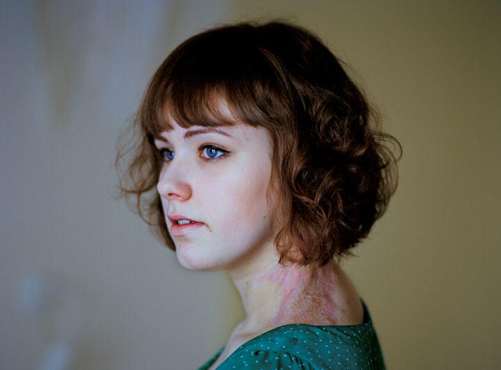 イルバ・シュウェンケ （当時15歳）