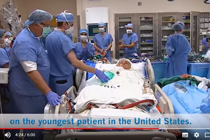 顔面移植手術を受けるケイティ・スターブルフィールド　Cleveland Clinic-YouTubeより